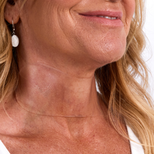 Load image into Gallery viewer, Neck Wrinkle Patch