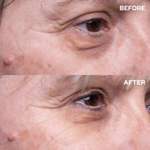 Load image into Gallery viewer, Eye Wrinkle Patches - One Pair