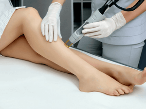 Laser Hair Removal - Painless Motus AY